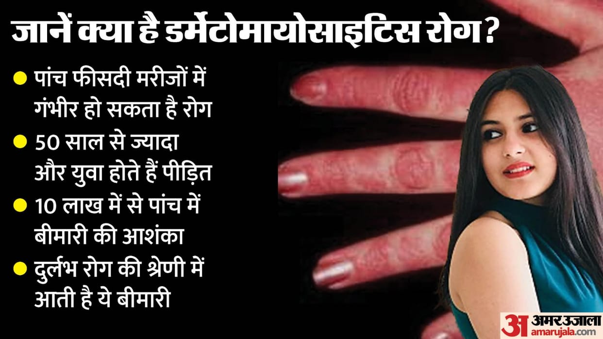 Suhani Bhatnagar What is disease killed Dangal girl how symptoms look like disease increases due to reasons