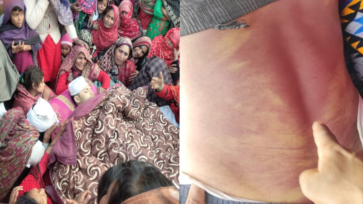 Shamli: Youth dies under suspicious circumstances, family accuse police of beating him