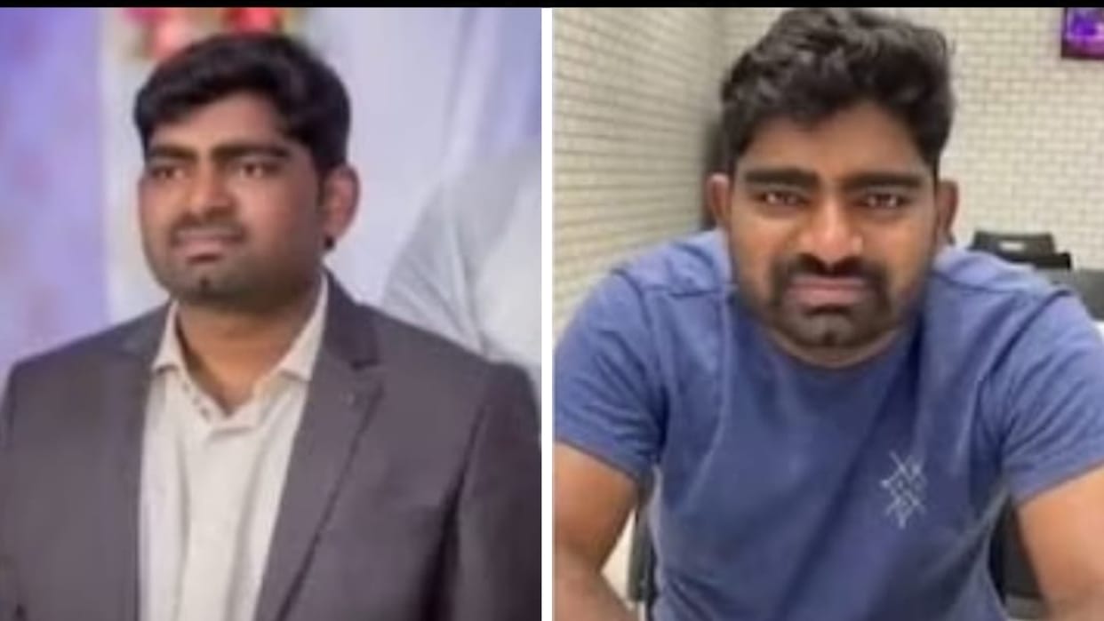 Hyderabad: Man died during smile enhancement surgery weeks before wedding