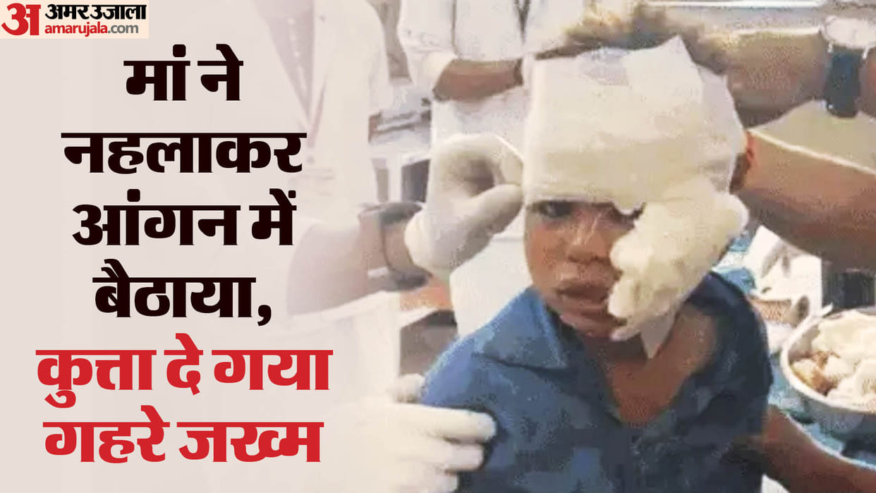 Dog Attacked five year old child and scratched his face in Banswara Hindi News