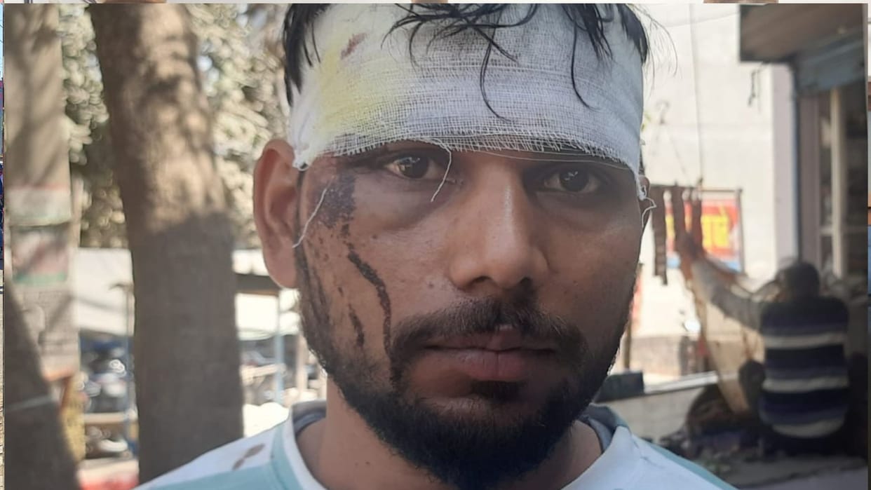 Supervisor accused of making video viral, fatally attacked with sharp weapon and rod in Deoria