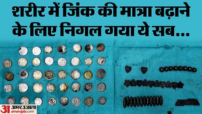 39 coins and 37 magnet pieces found in 26 year old youth stomach