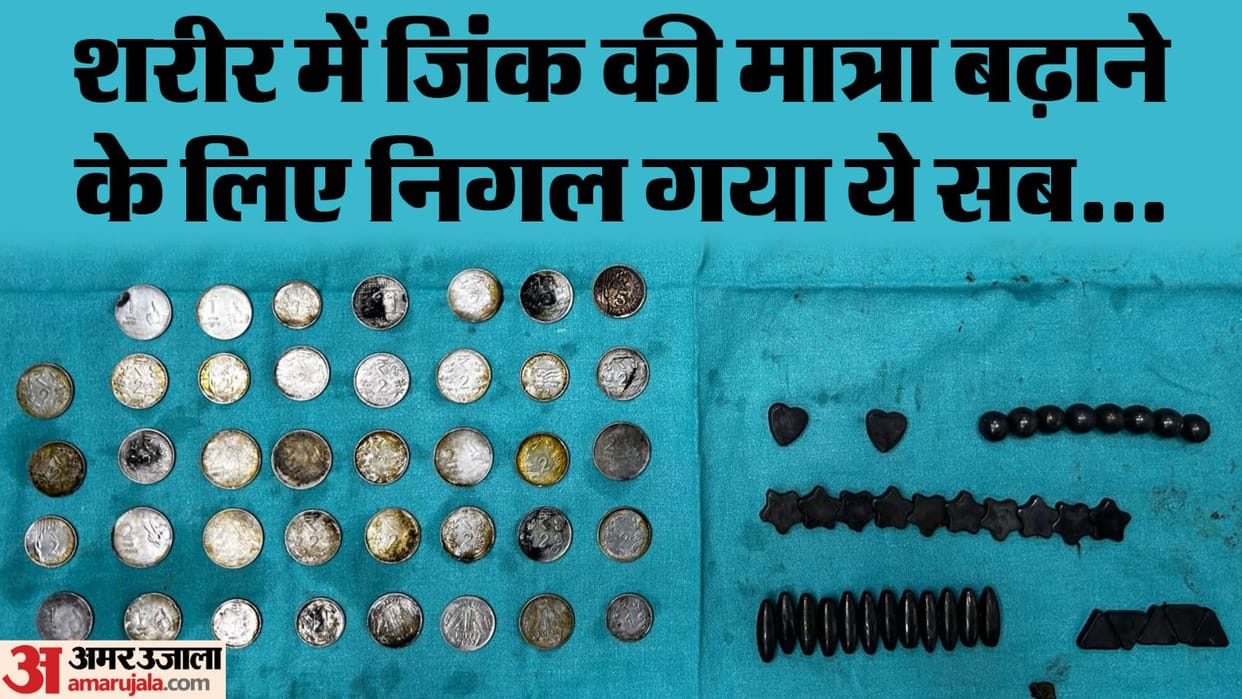 39 coins and 37 magnet pieces found in 26 year old youth stomach