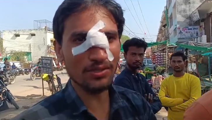 Home guards sons nose cut with a knife, miscreants took away cash and jewellery, targeted three houses