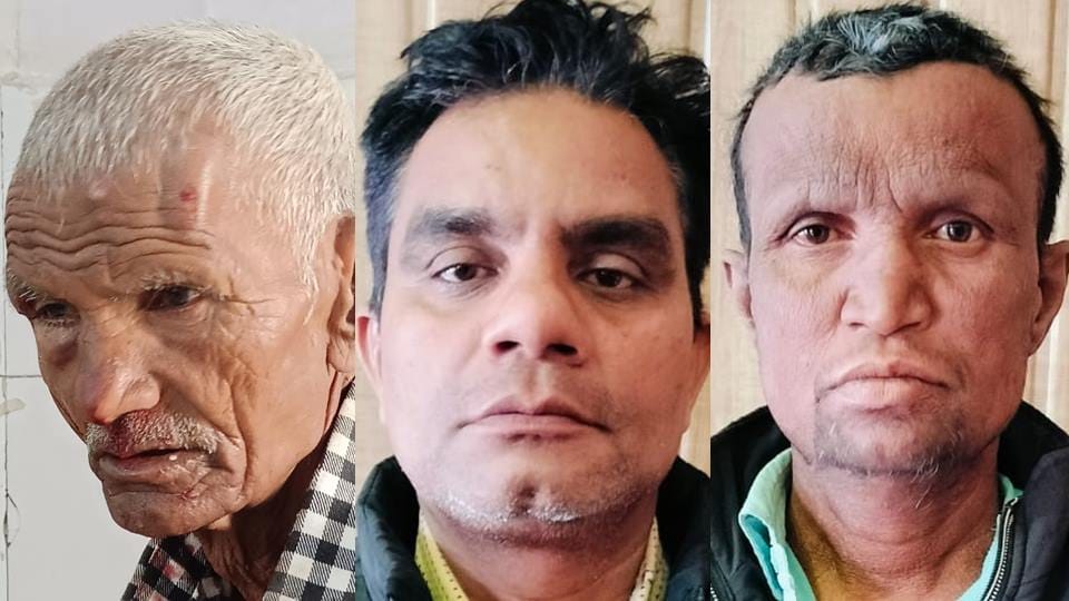 Rampur: After being hit injured old man was taken from CHC, when referred, he was thrown into canal