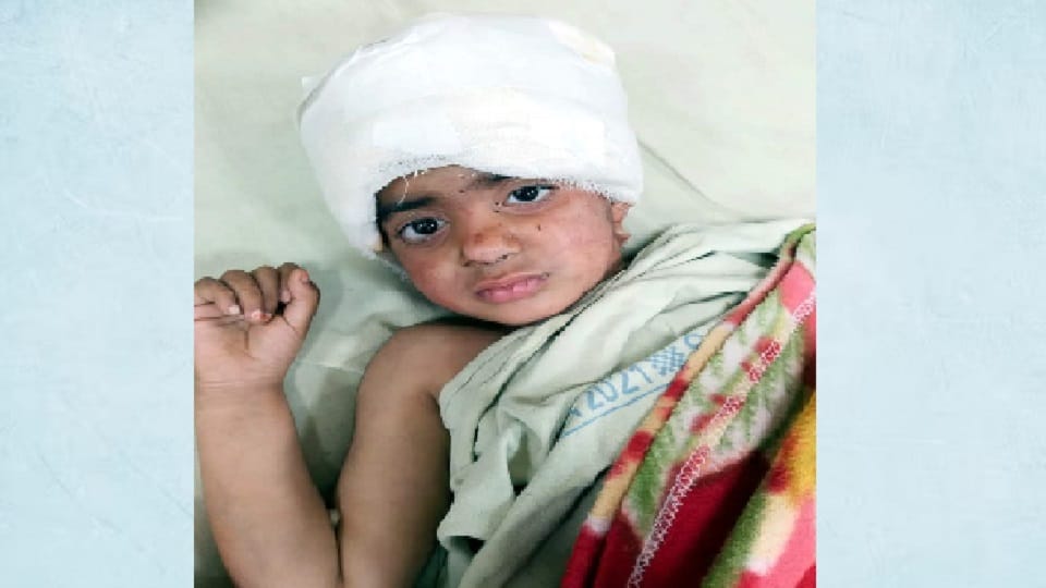 UP: Four-year-old girl was bitten by dogs in Amroha, 24 hours ago the innocent child had taken her life