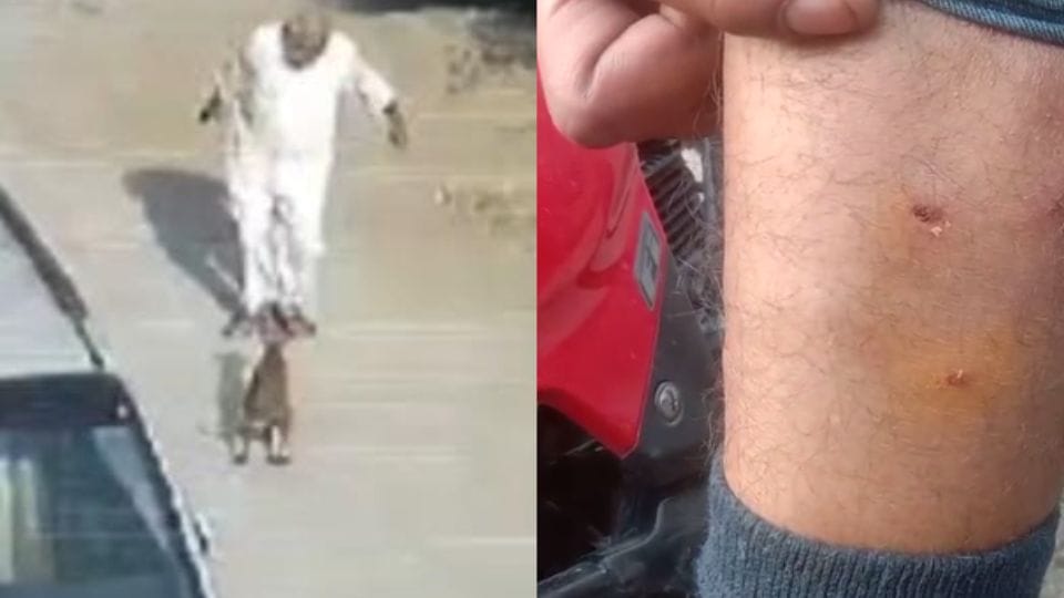 Dog attacks old man in Korba