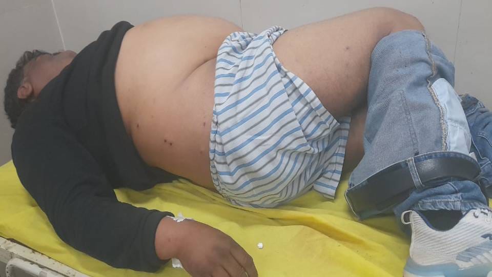 Drug dealer injured after being shot in back in Agra Police is investigating case