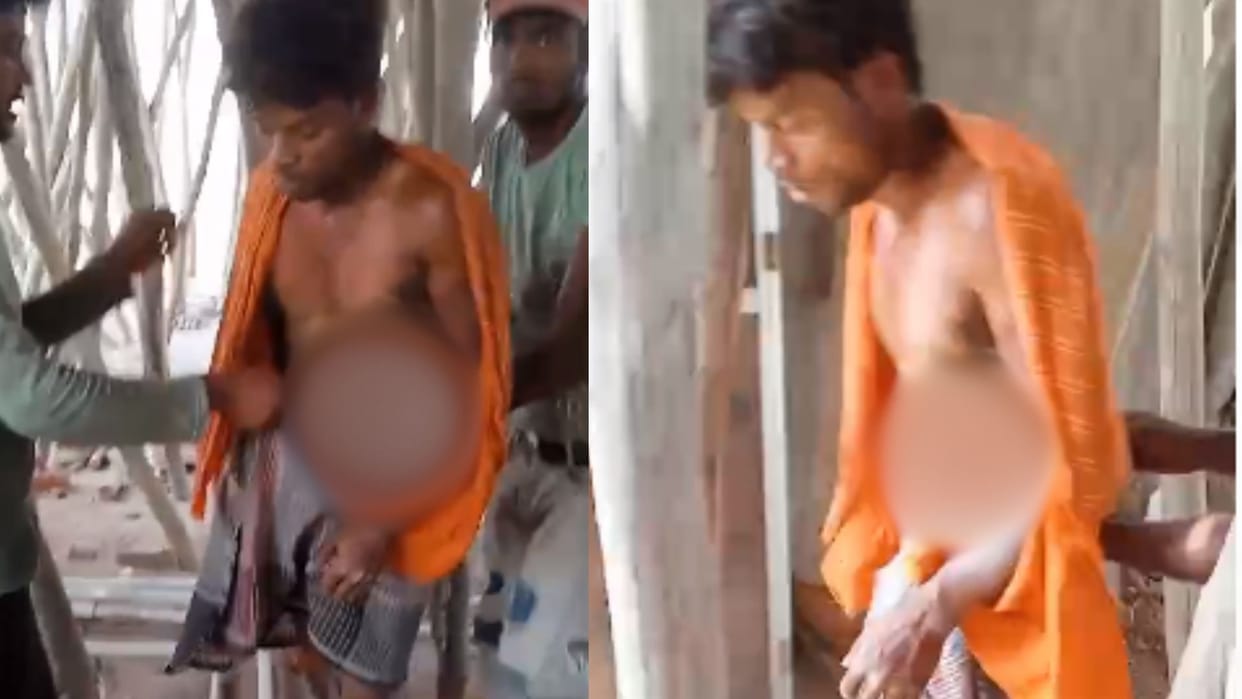 Laborer burnt by high tension wire during building construction in chandauli
