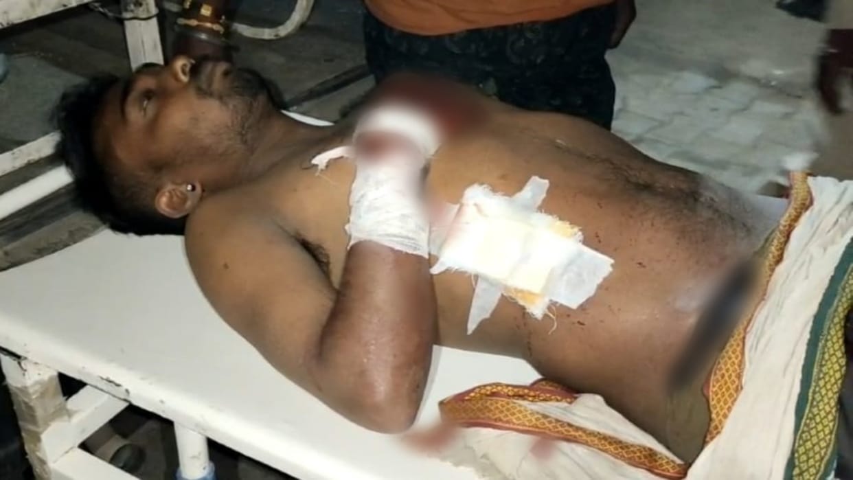 Bhojpur Crime: Criminals shot a hawker who went out to buy ration; Had a dispute with someone on way