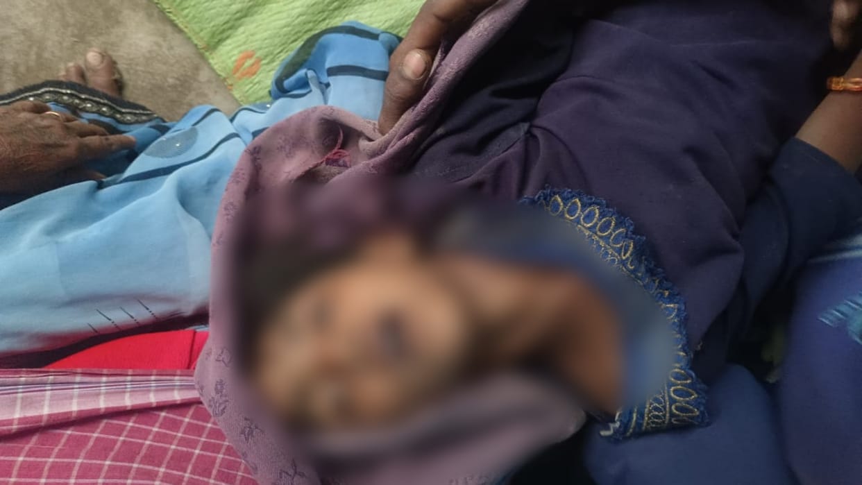Anuppur News Five year old girl dies due to electric shock