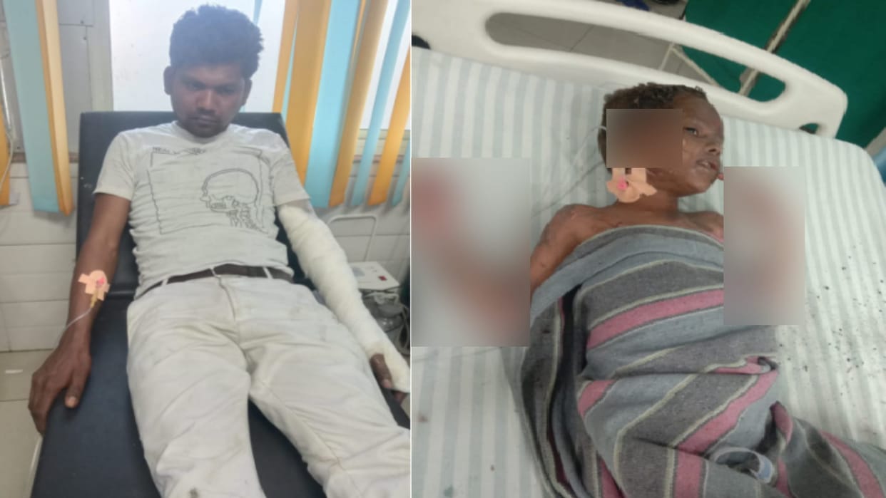 Bed caught fire due to short circuit in Modipuram of Meerut and four children, couple got burnt