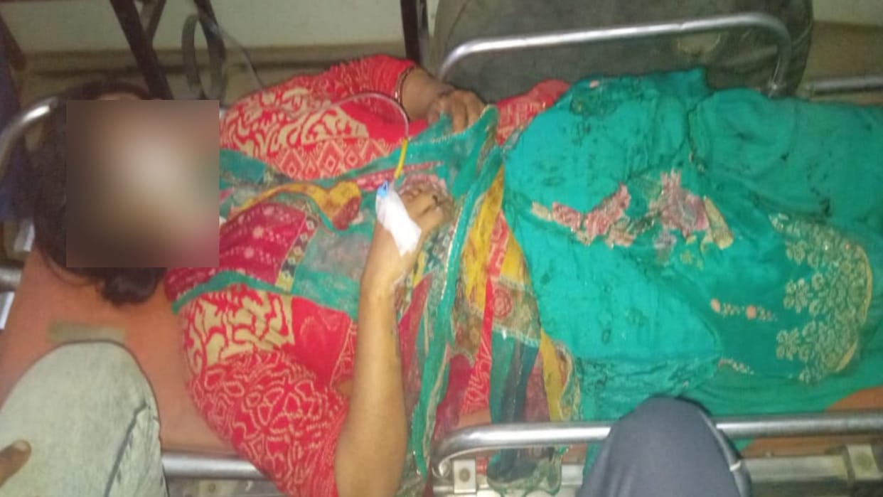 Acid thrown on a woman in Shamli and doctors referred her to higher center
