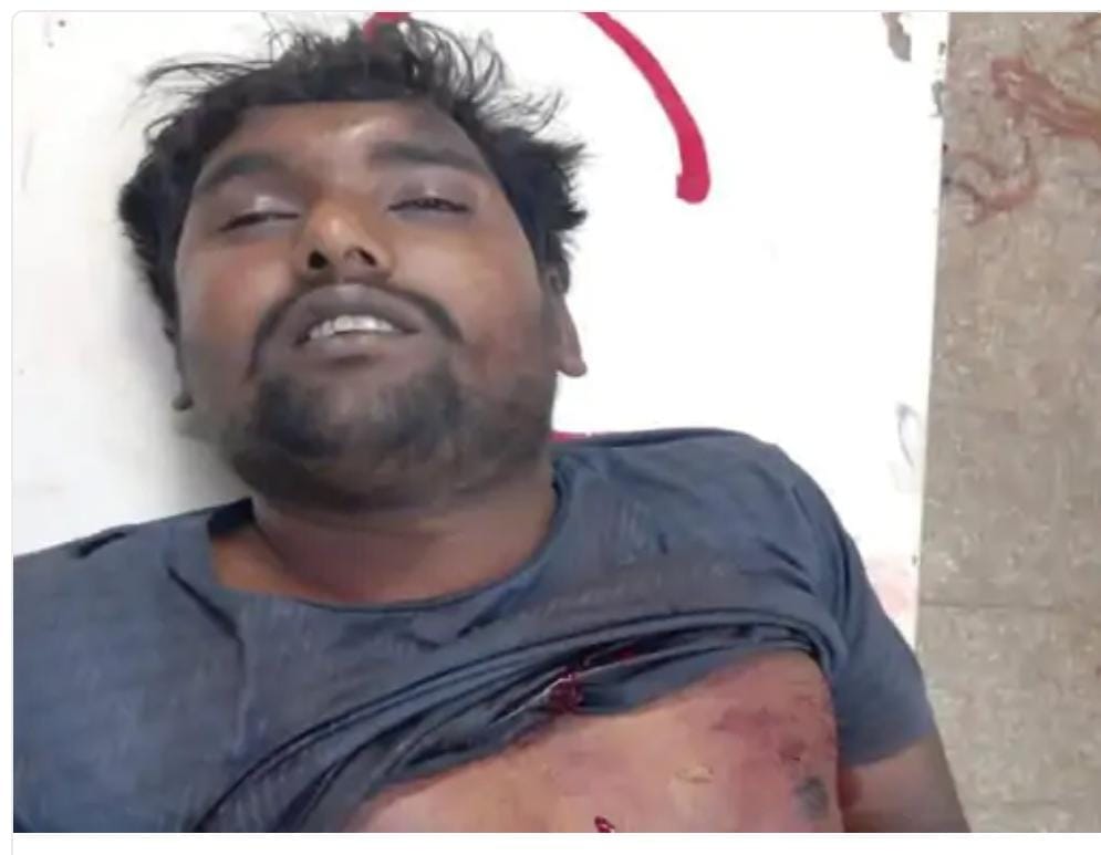 Indore: Murder for the third consecutive day, young man stabbed due to old rivalry, father's hands also cut of