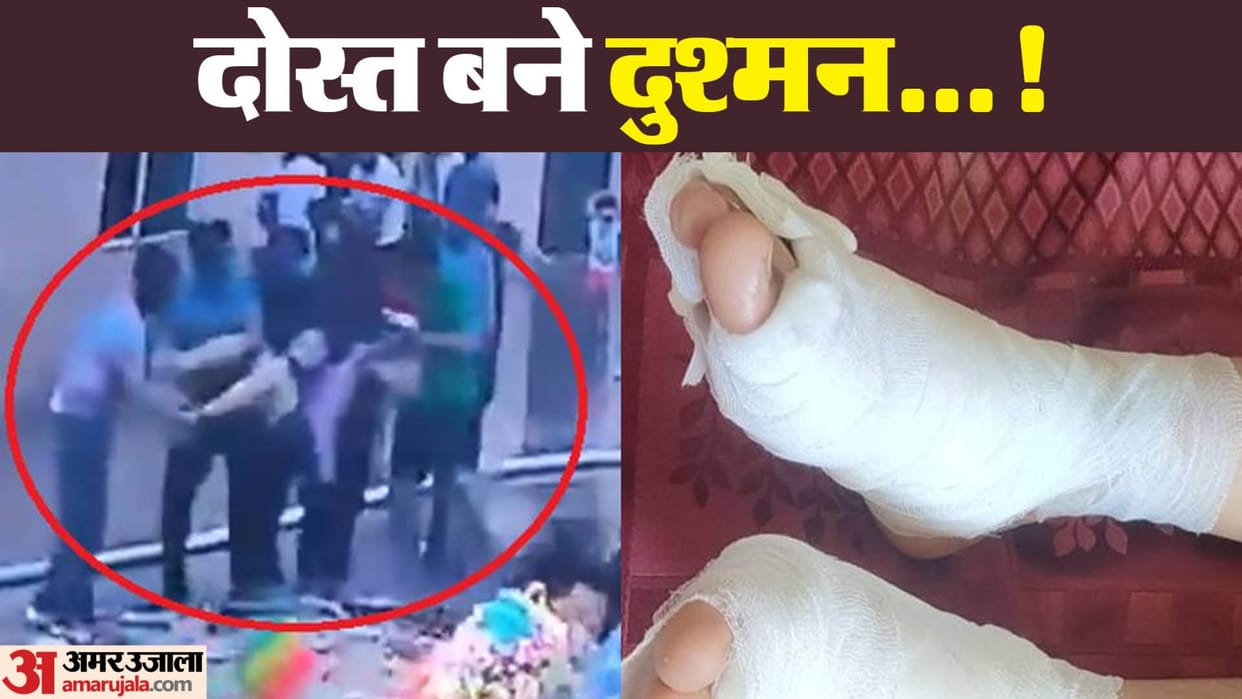 In Greater Noida four friends threw one of their friends in hot ashes of Holika Dahan both legs got burnt