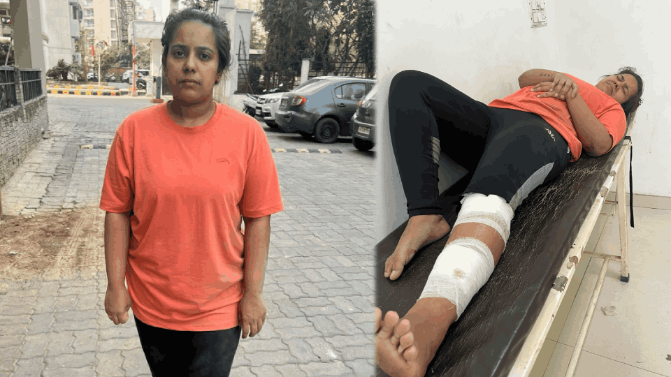 dogs attacked female senior software developer and bit her leg