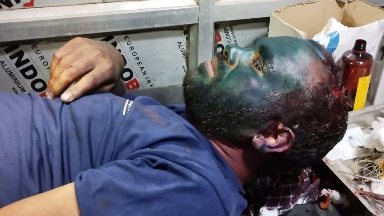 Deputy head of the village beat up many people on Holi