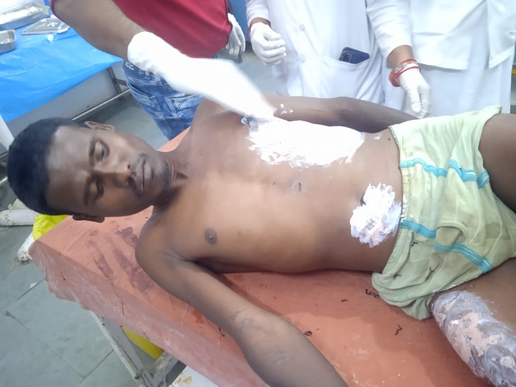 Young man injured after being electrocuted by a hunter in the forest of Farrisemer
