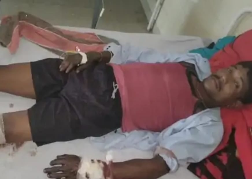 A bear attacked a man returning home from the farm, he is undergoing treatment in a critical condition
