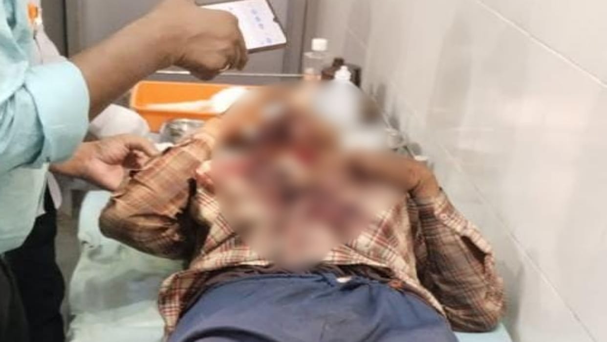 Umaria News Shepherd injured by tiger attack undergoing treatment in hospital