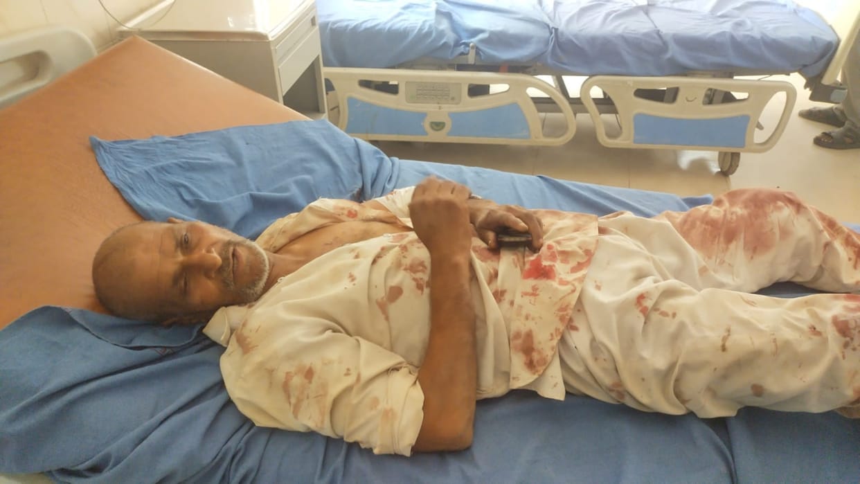 son beat his father badly In Fatehabad, had to stop him from quarreling with his wife