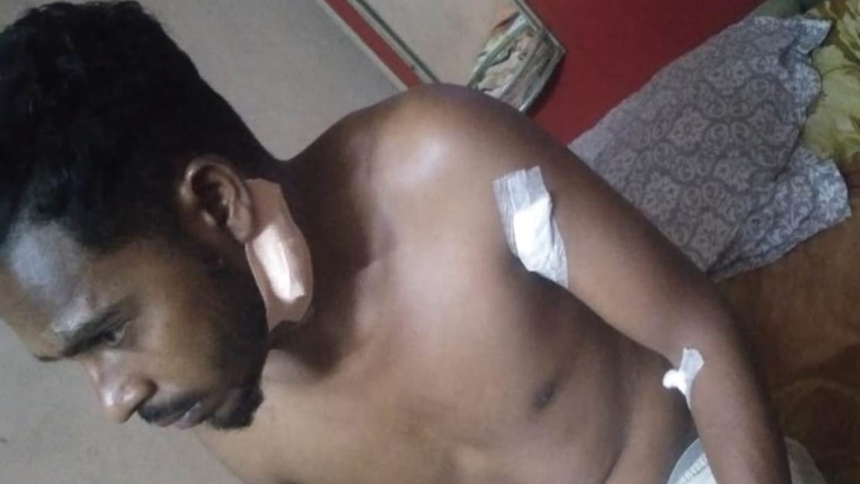 morale of miscreants high in Raipur: Youth attacked with knife in old rivalry, accused absconding