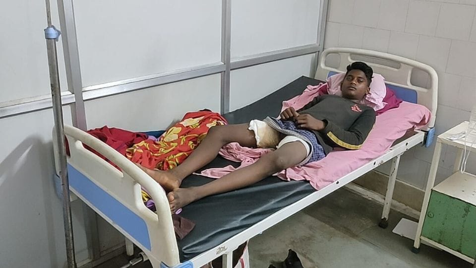 बच्चे को जलाया