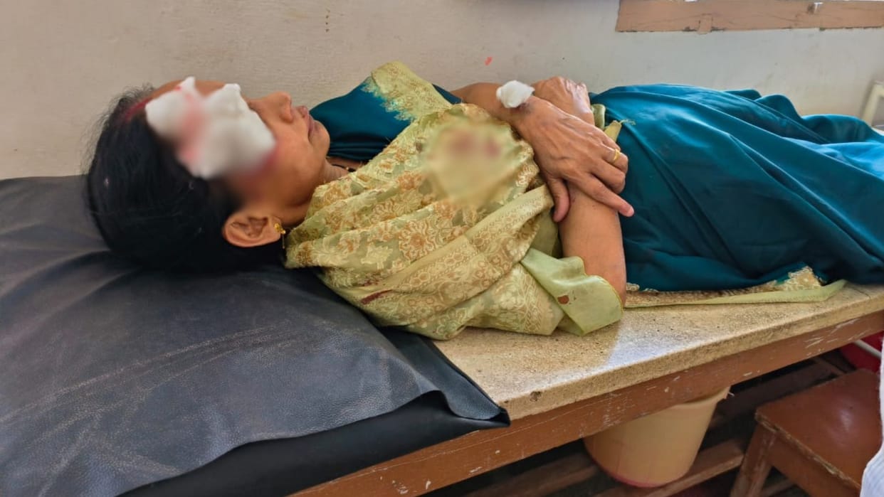 Vishwanath Temple former Mahant Family members injured in car accident in varanasi