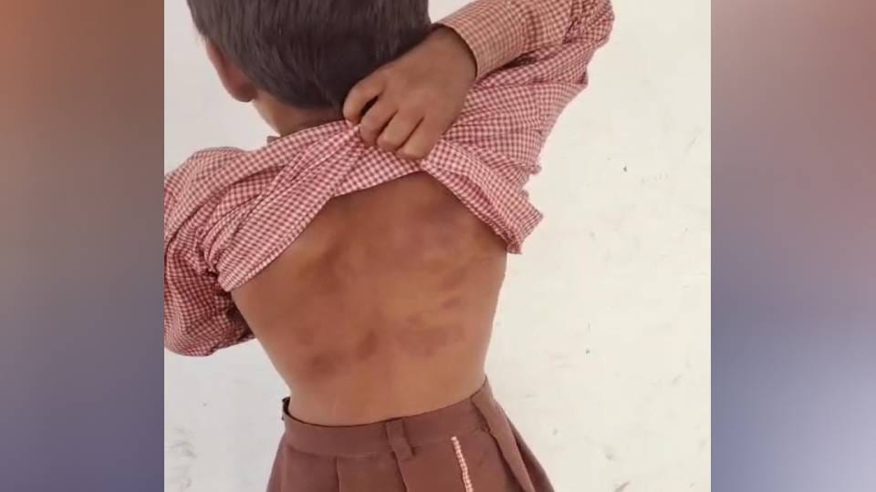 headmaster brutally beat fourth class student for plucking mulberry from tree In Firozabad