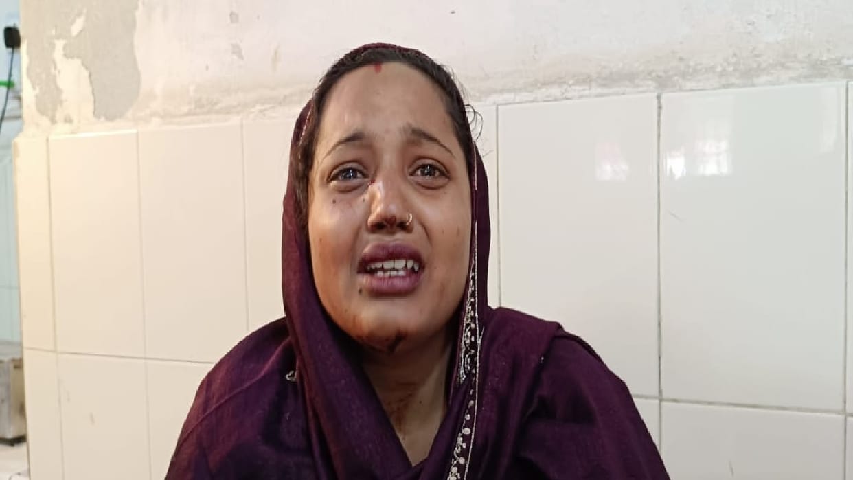 when daughter in law asked reason for less milk In Hansi, in laws beat her badly, she reached civil hospital i