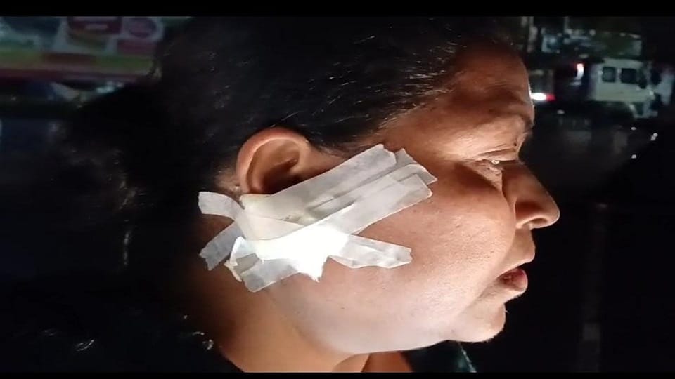 ear torn while snatching earrings Bike riding miscreants also took away chain