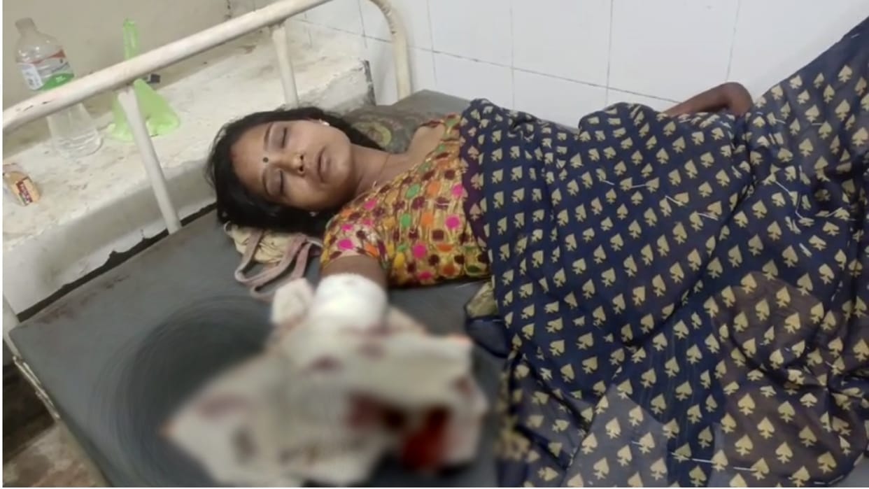 Due to character doubt husband cuts wife hand with an ax in Ashok Nagar