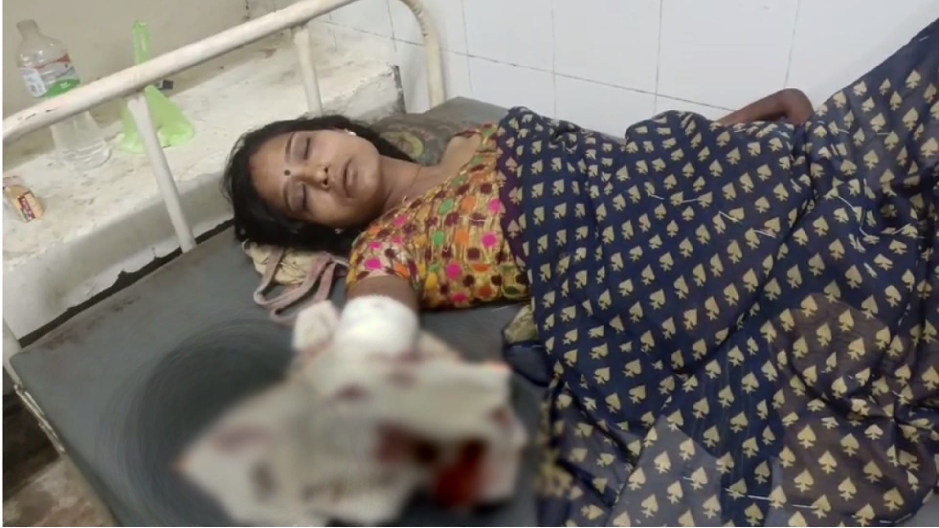 अस्पताल में भर्ती पीड़ित महिला।