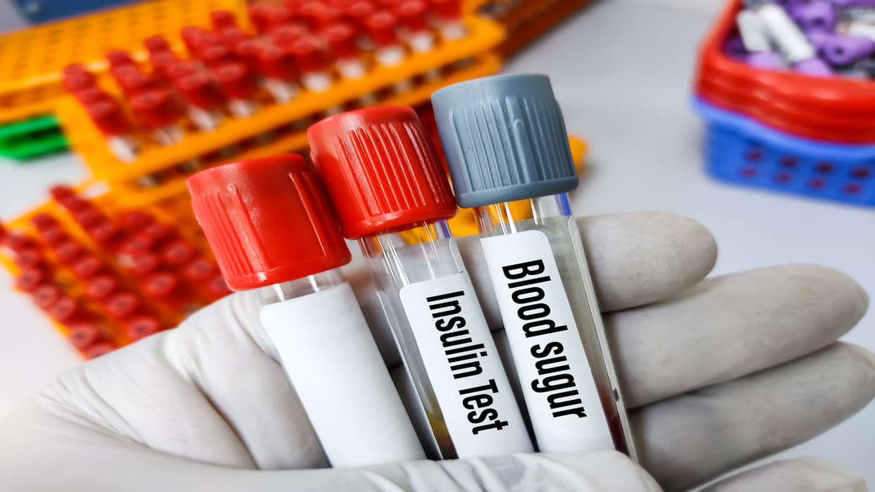 Diabetes came under control after skipping breakfast, shocking revelations came out in GSVM study