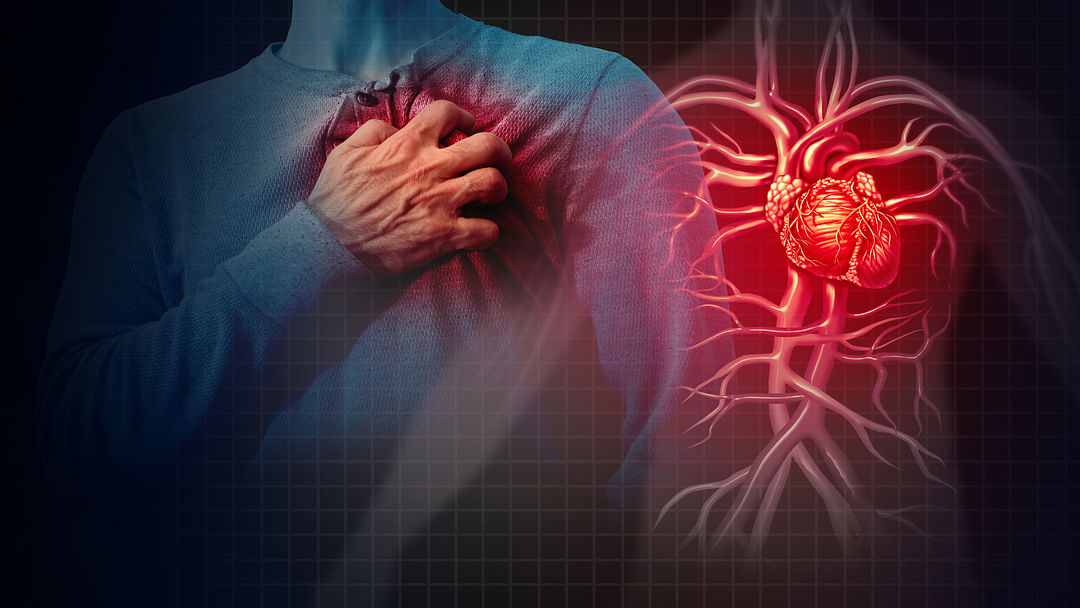 study says more than 6 in 10 U.S. adults will have heart disease heart attack and stroke risk