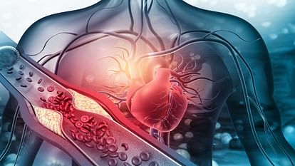 Heart attack and heart failure difference know what causes heart attack