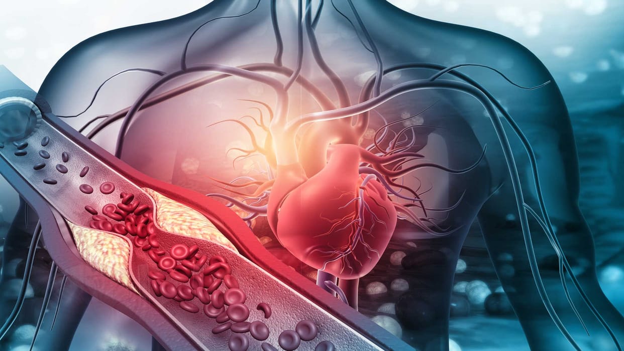 Triglyceride:क्या ट्राइग्लिसराइड बढ़ने से भी हो सकता है हार्ट अटैक? कैसे  रखें इसे कंट्रोल - Triglycerides Cause Heart Attack What Foods And Drinks  Increase Its Risk - Amar Ujala Hindi News Live