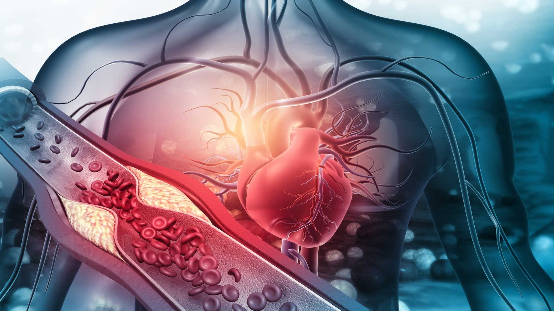 Heart attack and heart failure difference know what causes heart attack