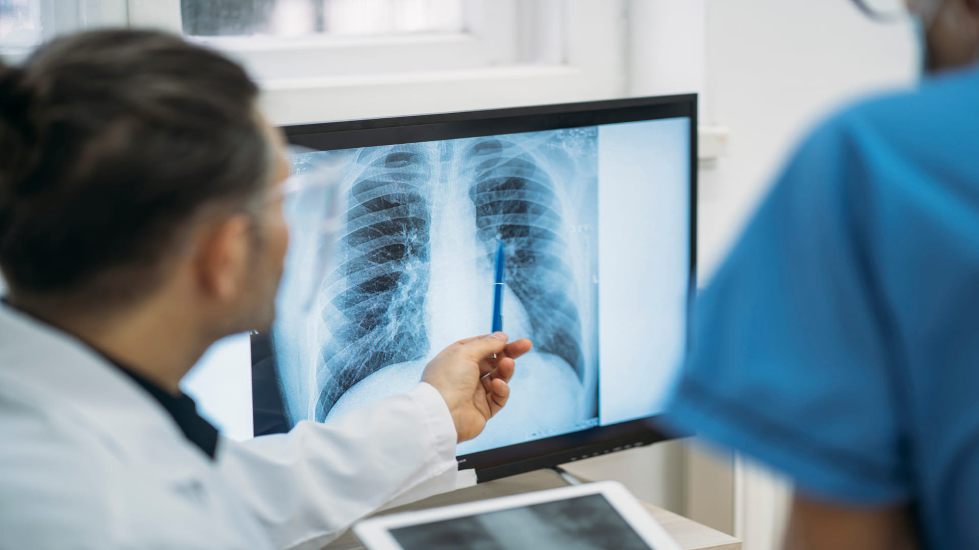 world lung day 2024 What causes lung cancer know its symptoms and prevention tips