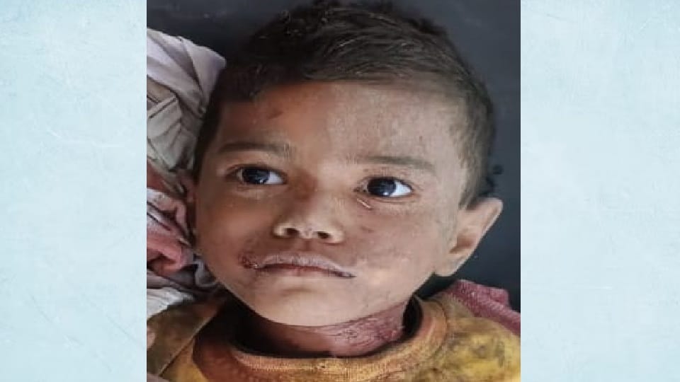 Gajraula: Dogs attacked and killed a seven year old girl.