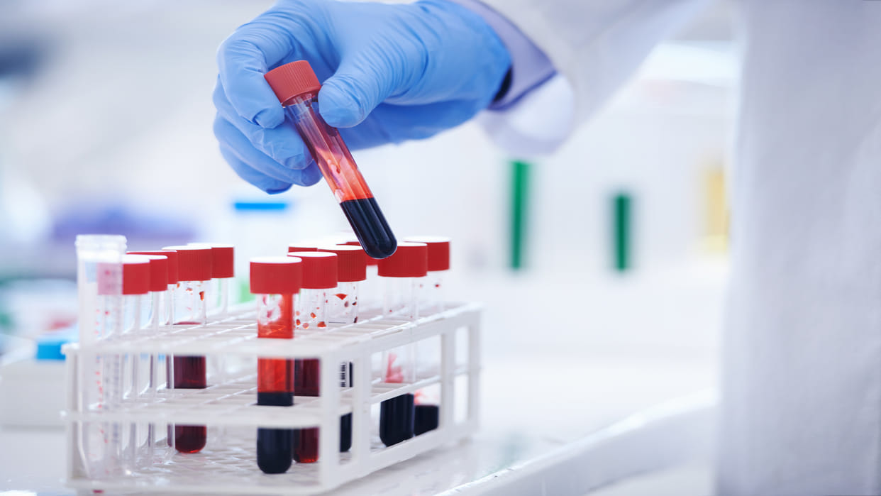 ai blood test reveals biological age and disease risk with accuracy