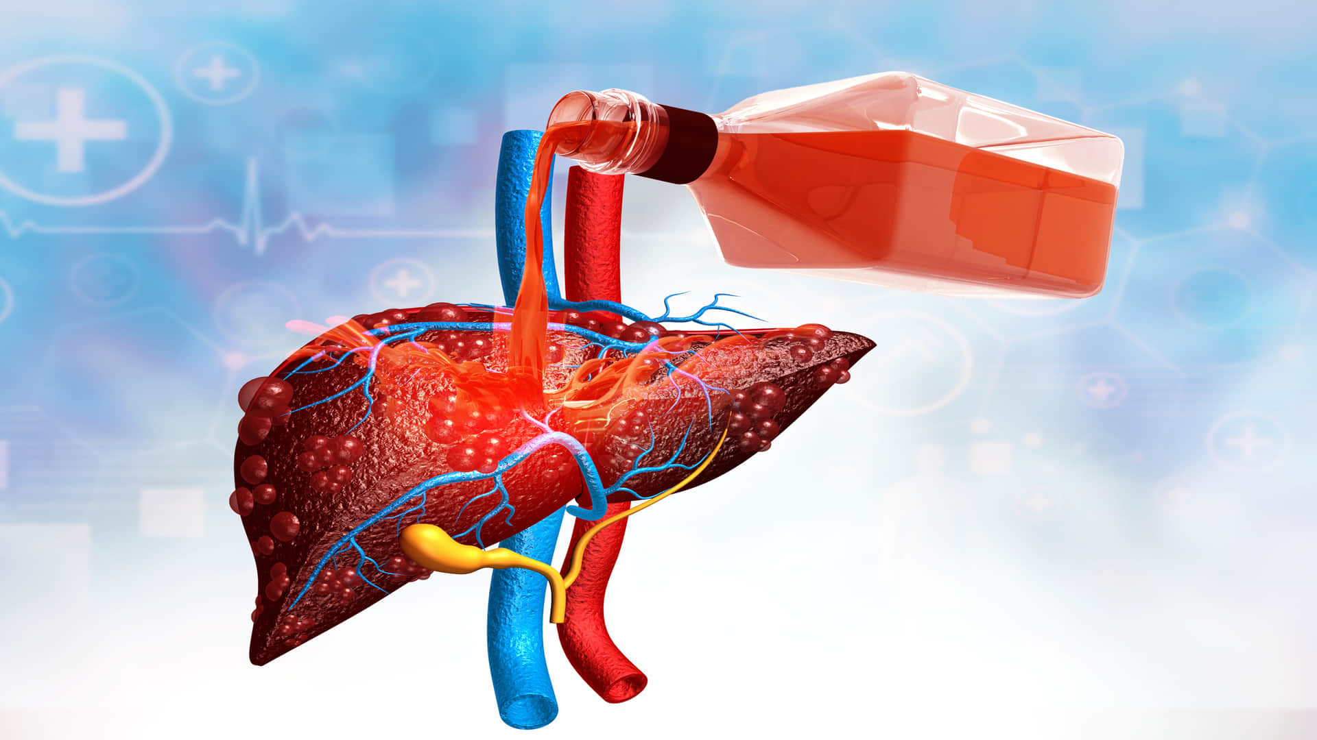 bad habits that cause fatty liver disease know  what causes fat in liver