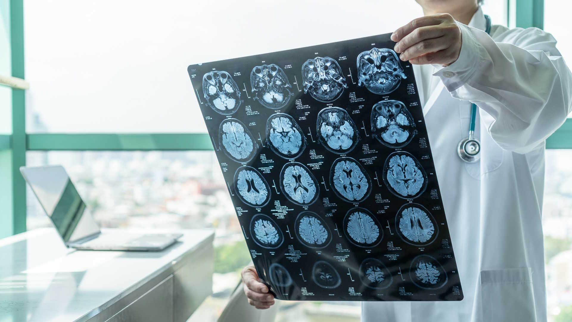 latest study finds Mobile phones are not linked to brain and head cancer