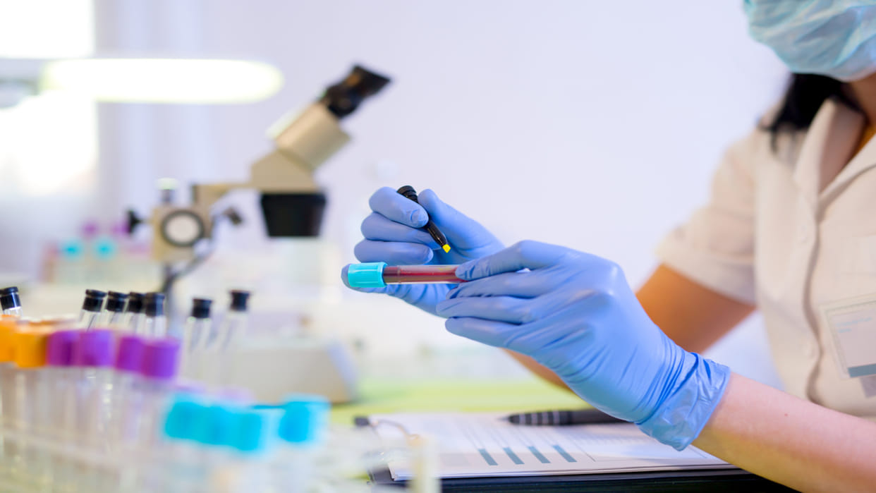 Smart App will instantly identify lack of blood in body anemia can be identified in pregnant women
