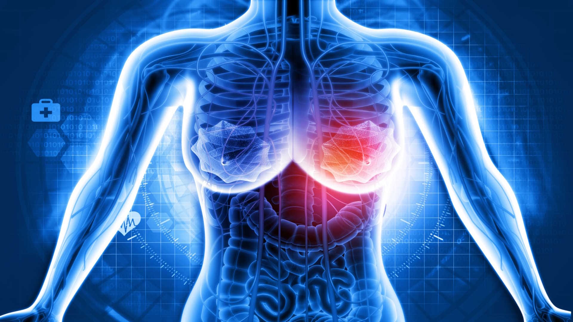 What causes breast cancer in your 20s and 30s know its risk factor and causes in hindi