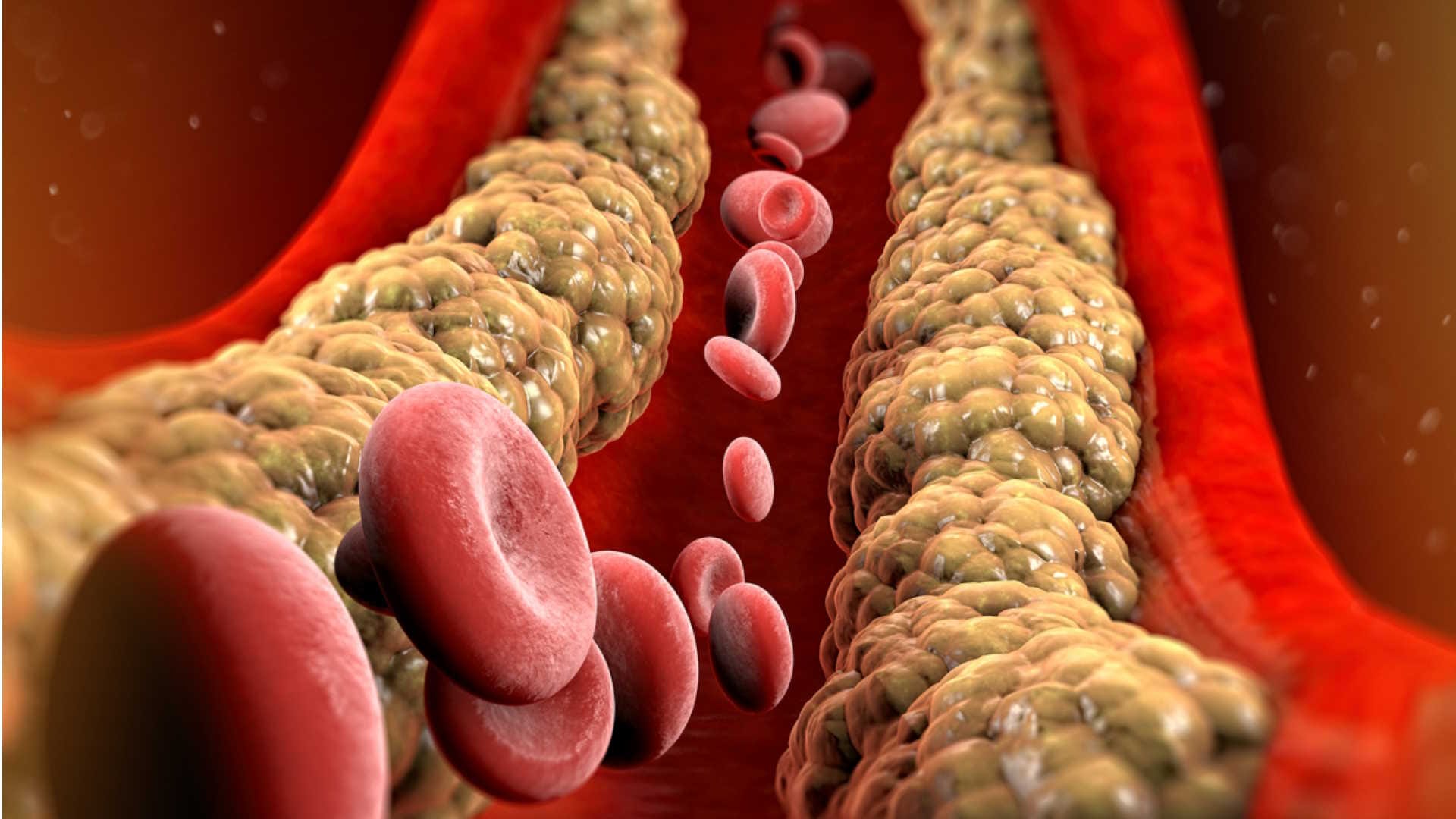 what is cholesterol and how does it affect the body know habits to reduce bad cholesterol level