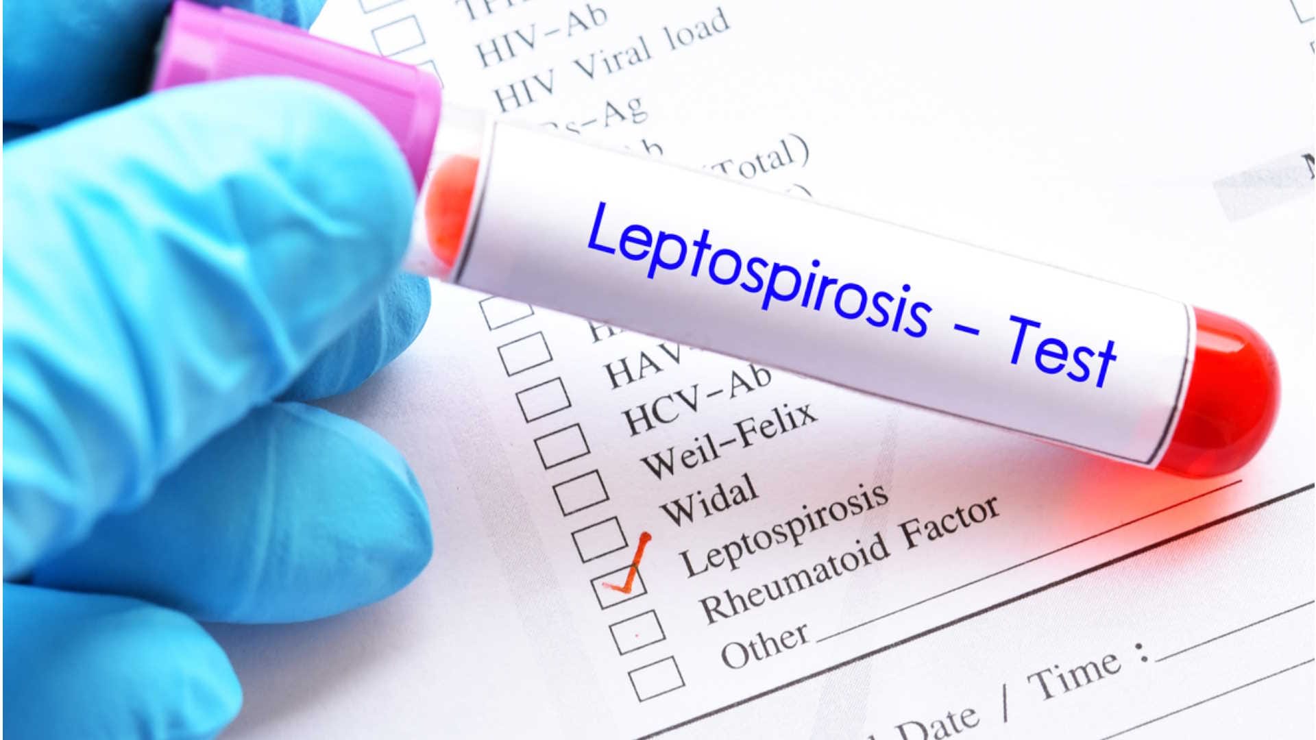 leptospirosis cases and death rate know leptospirosis causes and risk factors in hindi