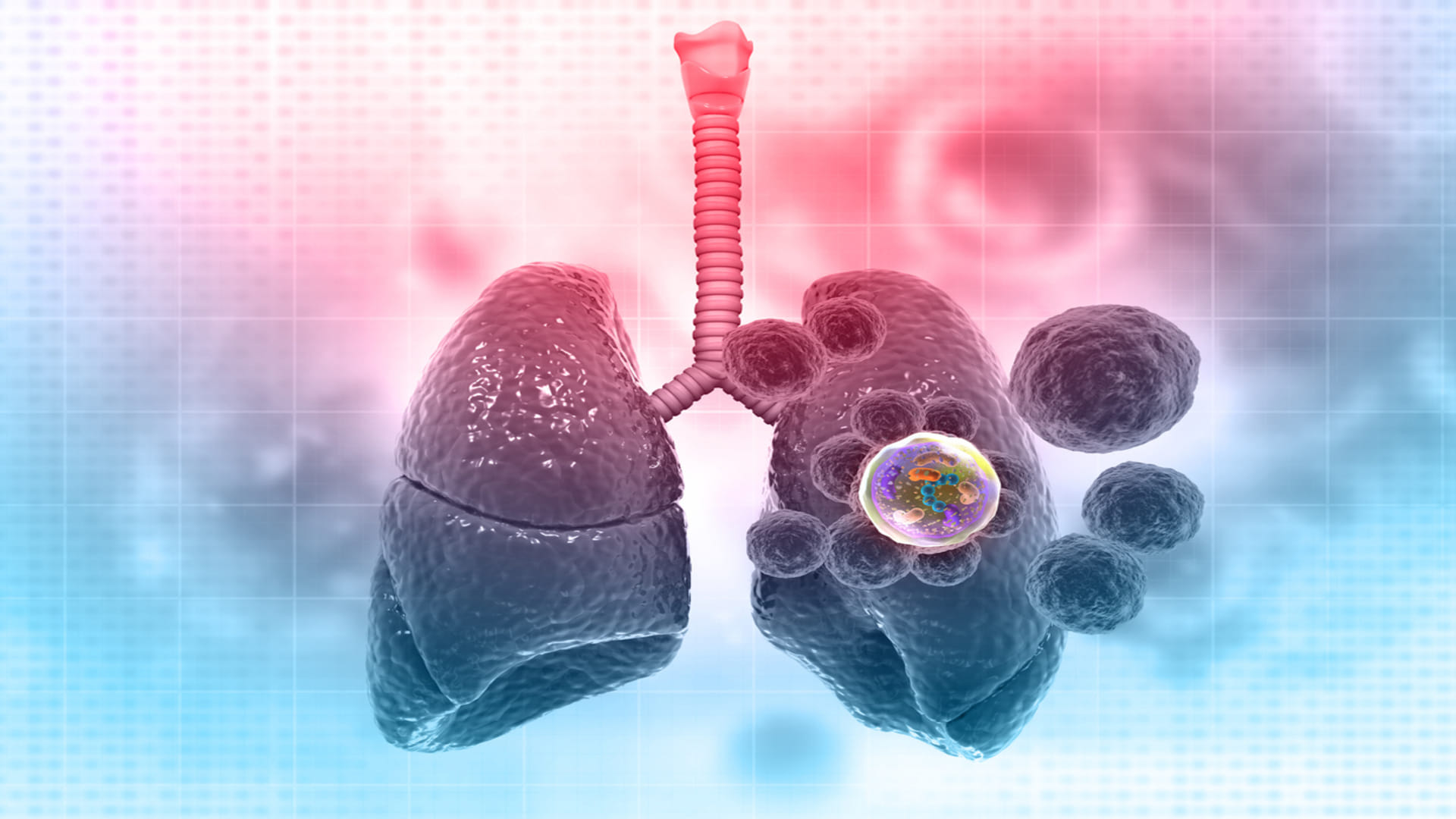 lungs cancer stages and risk know Lung Cancer Among People Who Never Smoked in hindi