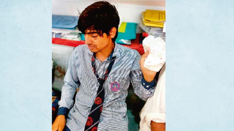 Moradabad: Teacher threw stick and hit student, injury to student eye, victim lodged complaint with police