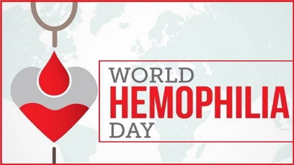 Hemophilia Day: More than 200 children suffering from hemophilia undergoing treatment in SN Medical College